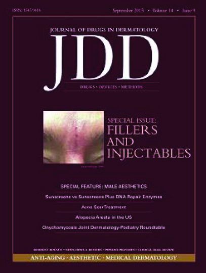 jdd